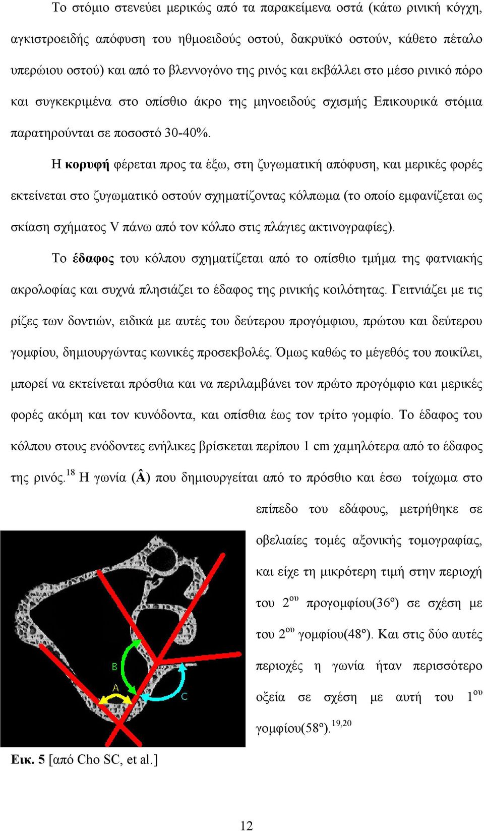 Η κορυφή φέρεται προς τα έξω, στη ζυγωµατική απόφυση, και µερικές φορές εκτείνεται στο ζυγωµατικό οστούν σχηµατίζοντας κόλπωµα (το οποίο εµφανίζεται ως σκίαση σχήµατος V πάνω από τον κόλπο στις