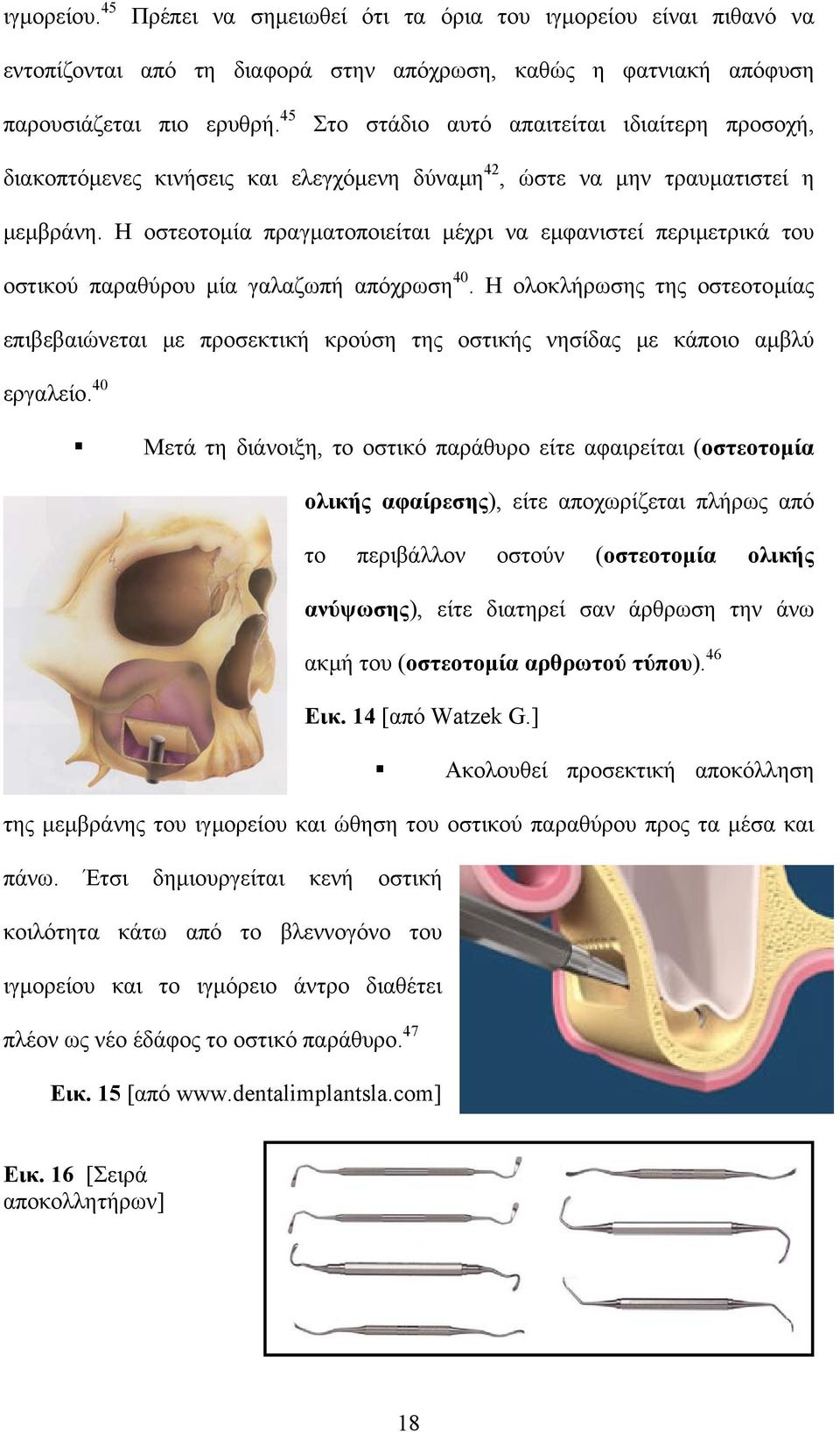 Η οστεοτοµία πραγµατοποιείται µέχρι να εµφανιστεί περιµετρικά του οστικού παραθύρου µία γαλαζωπή απόχρωση 40.