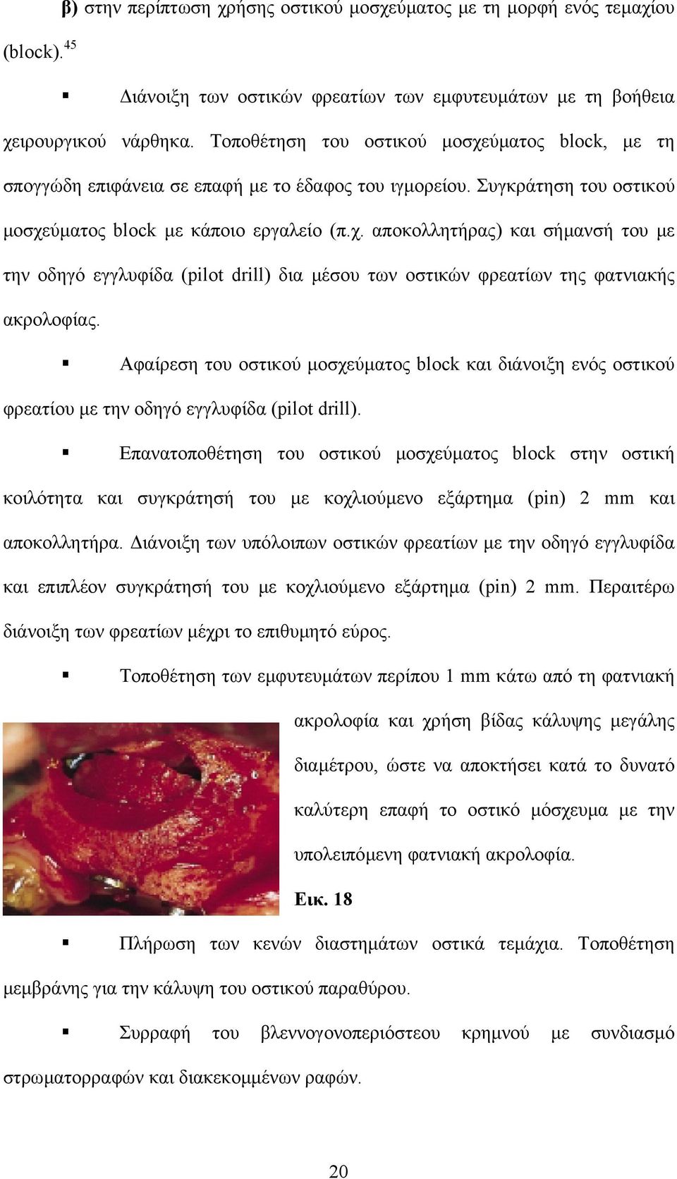 Αφαίρεση του οστικού µοσχεύµατος block και διάνοιξη ενός οστικού φρεατίου µε την οδηγό εγγλυφίδα (pilot drill).