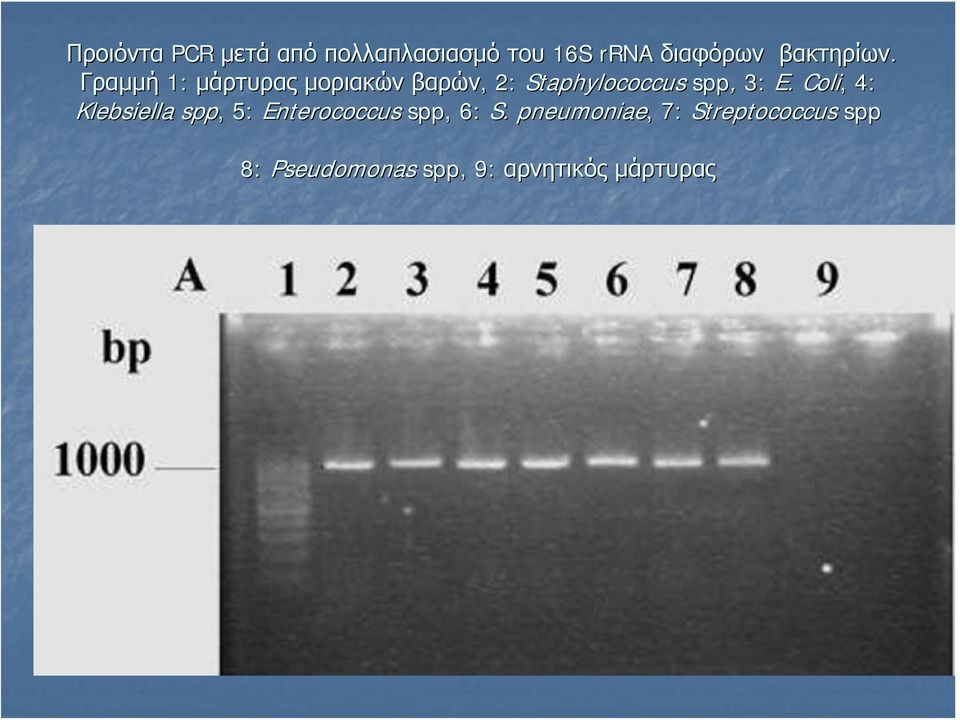 Γραμμή 1: μάρτυρας μοριακών βαρών,, 2: Staphylococcus spp, 3: E.