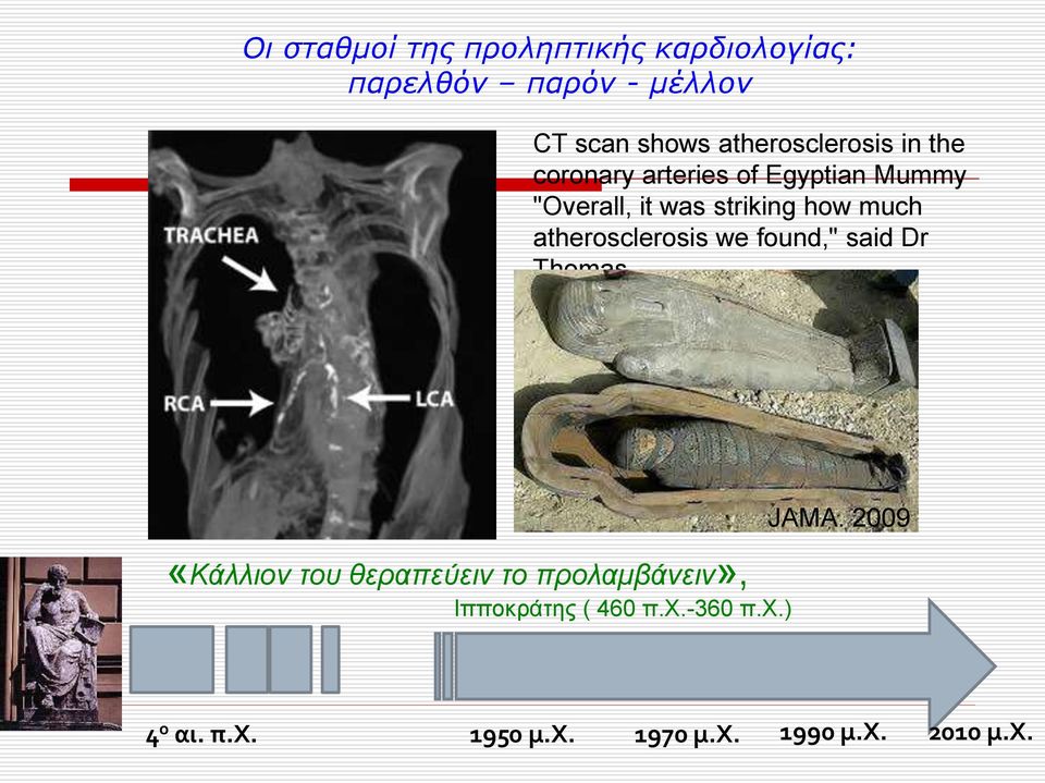 much atherosclerosis we found," said Dr Thomas.