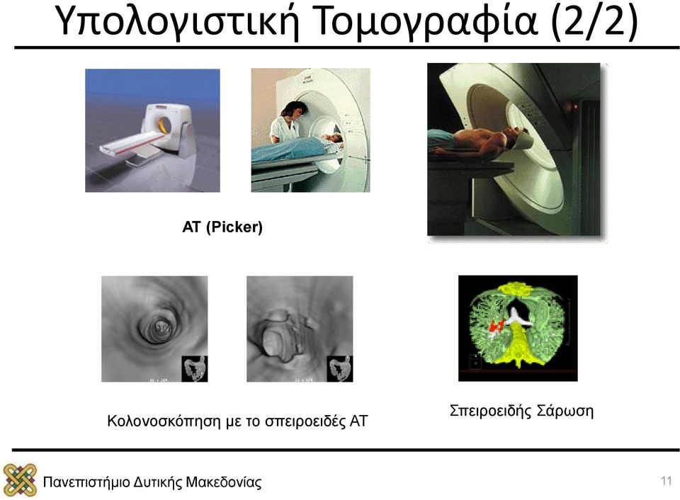 Κολονοσκόπηση με το