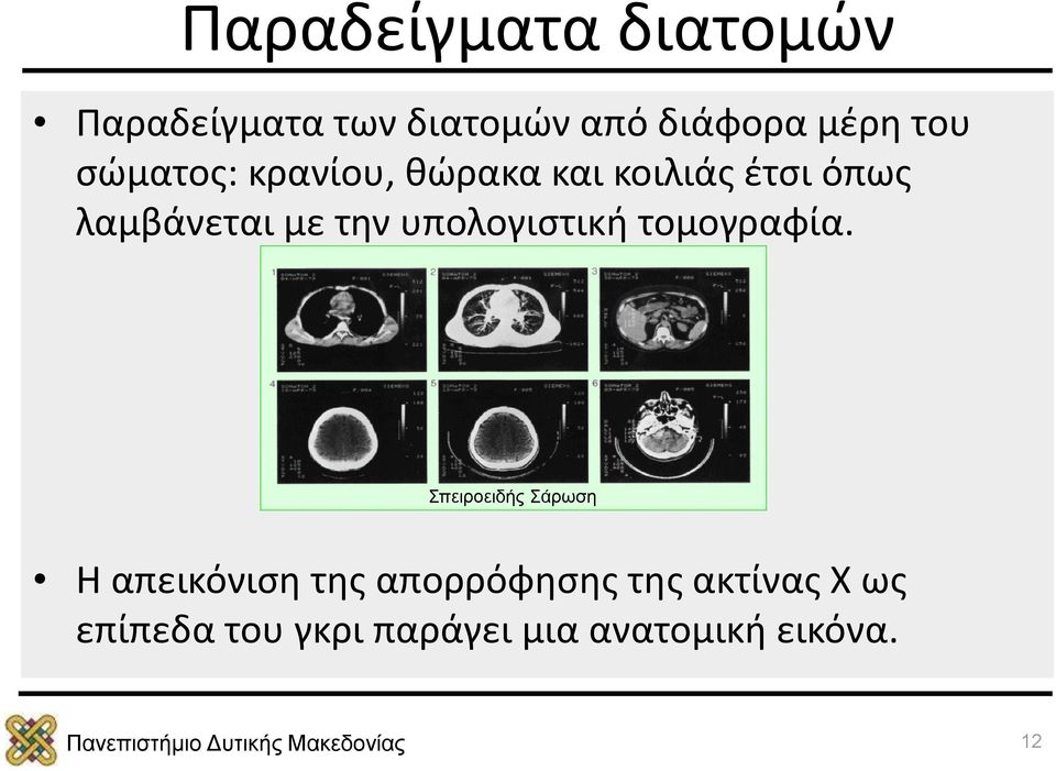 υπολογιστική τομογραφία.