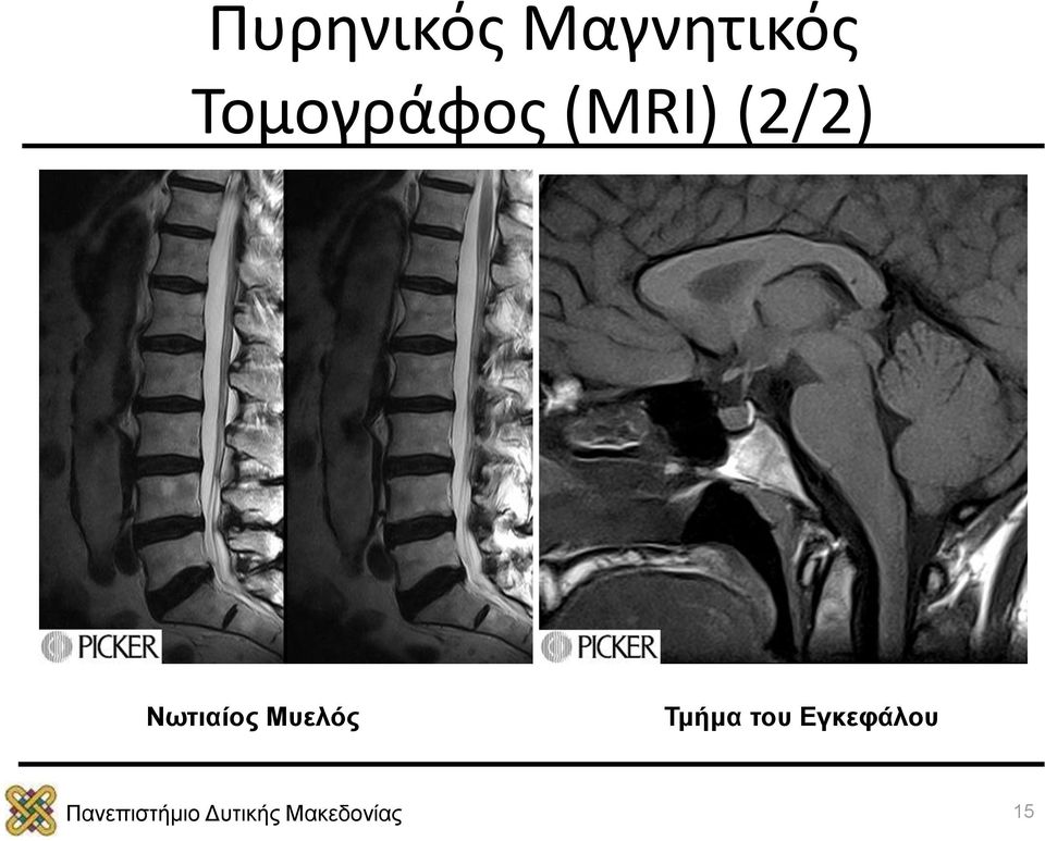 (2/2) Νωτιαίος