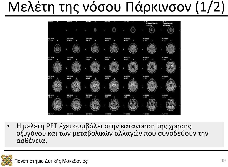 κατανόηση της χρήσης οξυγόνου και των