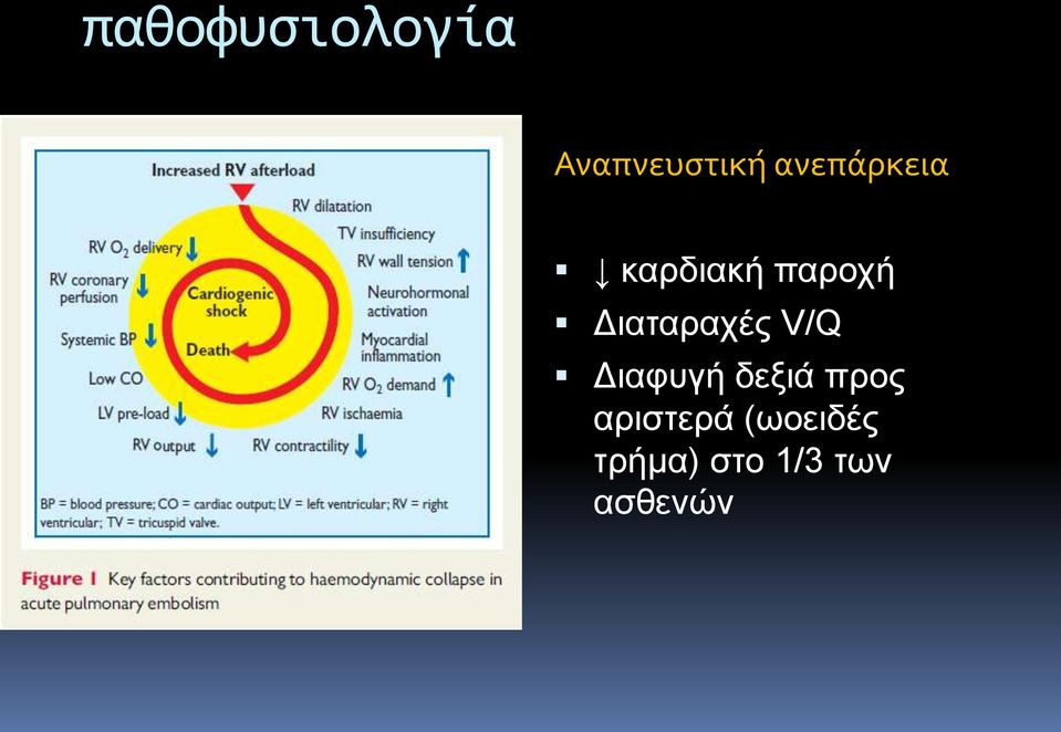 Διαταραχές V/Q Διαφυγή δεξιά προς