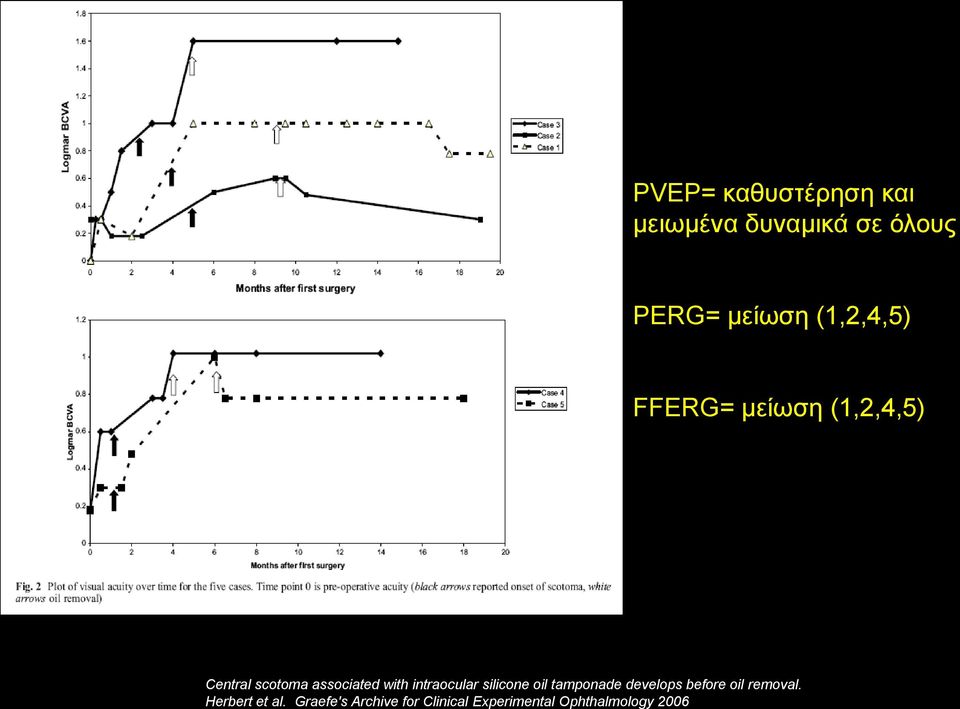 intraocular silicone oil tamponade develops before oil removal.