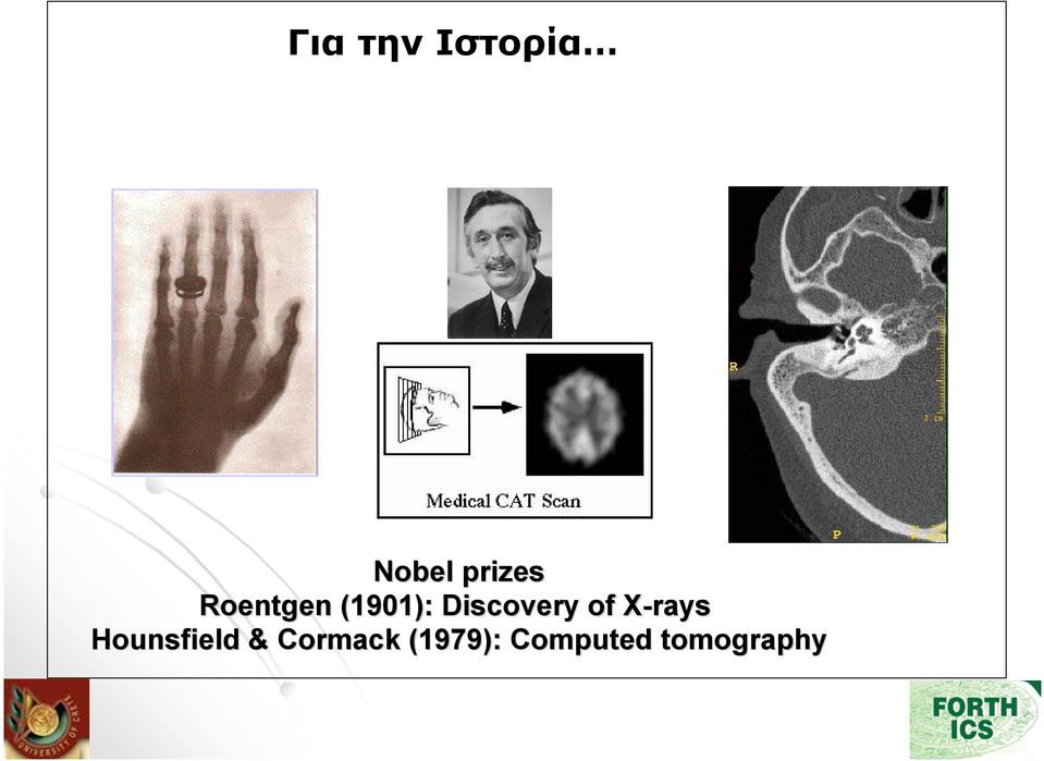 of X-rays X Hounsfield &