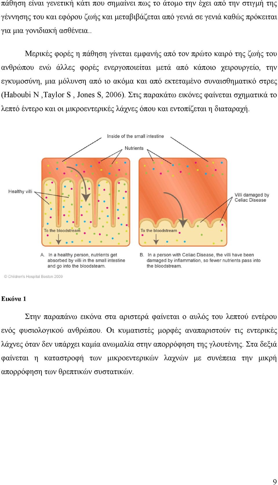 εκτεταµένο συναισθηµατικό στρες (Haboubi N,Taylor S, Jones S, 2006). Στις παρακάτω εικόνες φαίνεται σχηµατικά το λεπτό έντερο και οι µικροεντερικές λάχνες όπου και εντοπίζεται η διαταραχή.