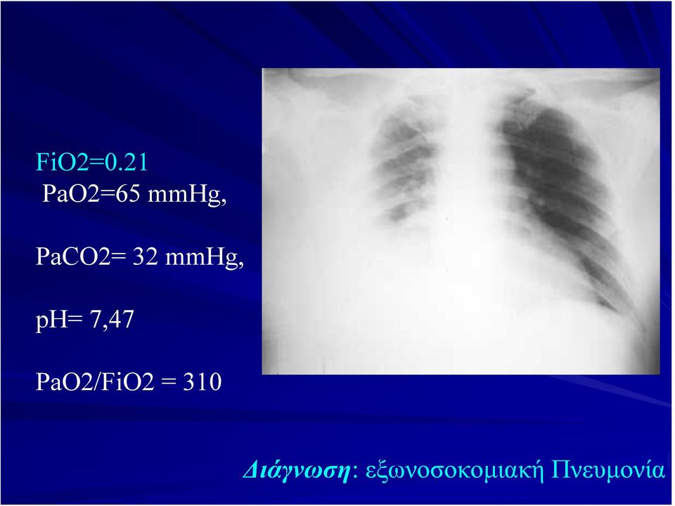 32 mmhg, ph= 7,47