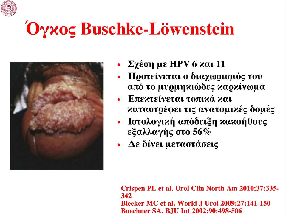 γκος Buschke-Löwenstein Σχέση με HPV 6 και 11 Προτείνεται ο διαχωρισμός του από το