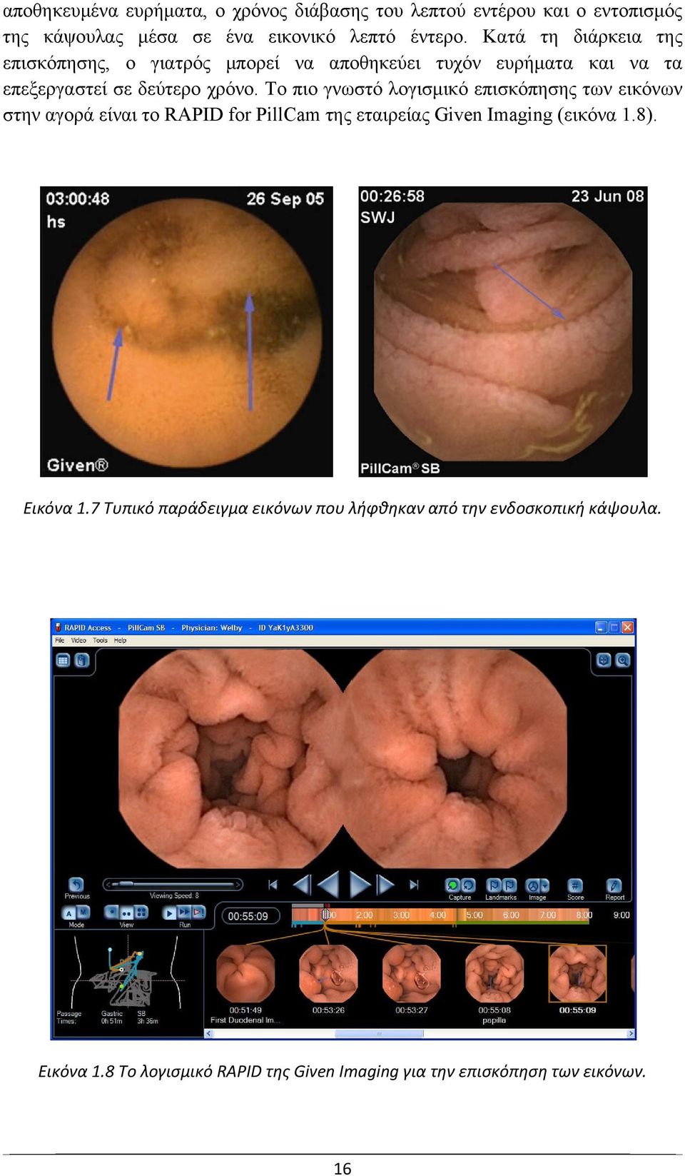 Το πιο γνωστό λογισμικό επισκόπησης των εικόνων στην αγορά είναι το RAPID for PillCam της εταιρείας Given Imaging (εικόνα 1.8).