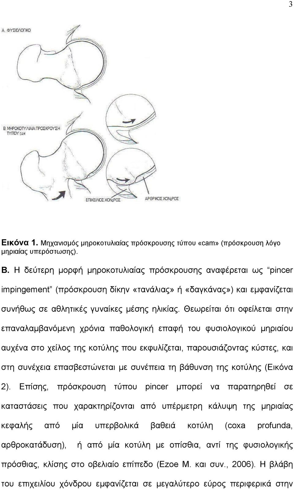 Θεωρείται ότι οφείλεται στην επαναλαμβανόμενη χρόνια παθολογική επαφή του φυσιολογικού μηριαίου αυχένα στο χείλος της κοτύλης που εκφυλίζεται, παρουσιάζοντας κύστες, και στη συνέχεια επασβεστώνεται