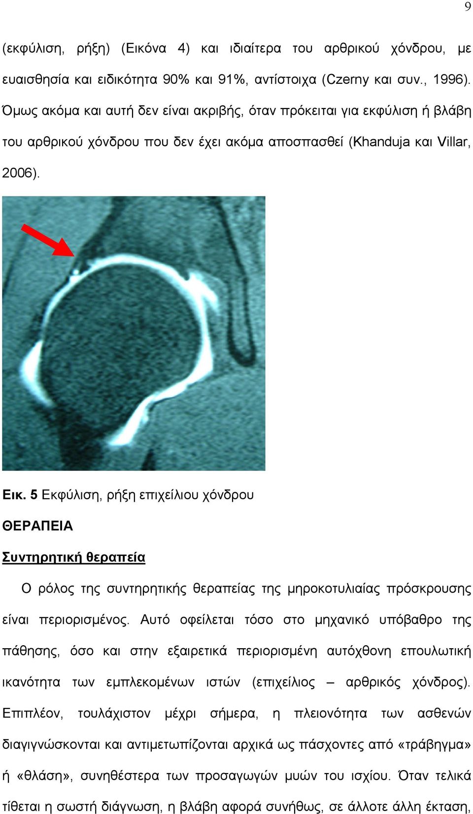 5 Εκφύλιση, ρήξη επιχείλιου χόνδρου ΘΕΡΑΠΕΙΑ Συντηρητική θεραπεία Ο ρόλος της συντηρητικής θεραπείας της μηροκοτυλιαίας πρόσκρουσης είναι περιορισμένος.