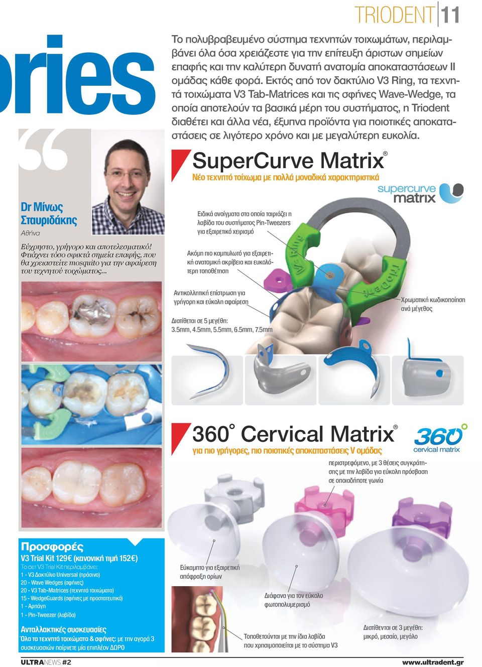 Εκτός από τον δακτύλιο V3 Ring, τα τεχνητά τοιχώματα V3 Tab-Matrices και τις σφήνες Wave-Wedge, τα οποία αποτελούν τα βασικά μέρη του συστήματος, η Triodent διαθέτει και άλλα νέα, έξυπνα προϊόντα για