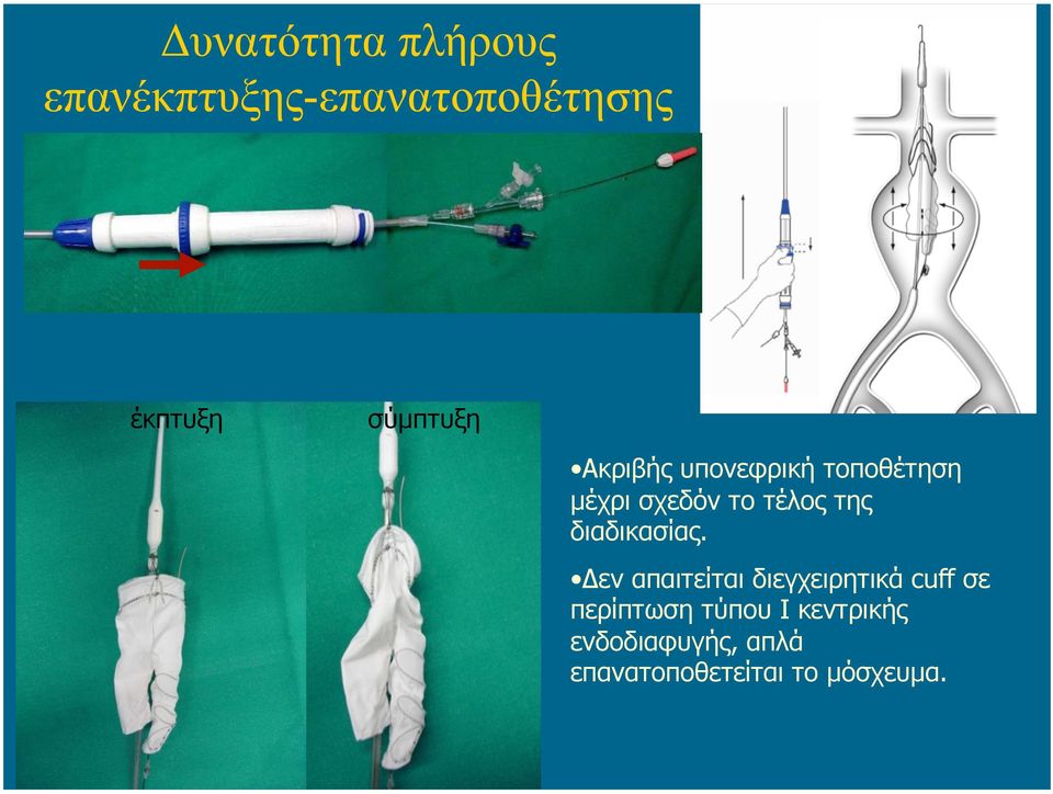 της διαδικασίας.