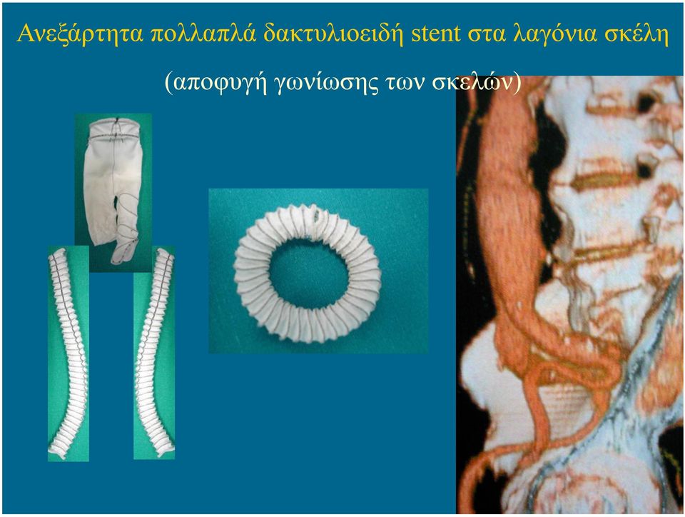 στα λαγόνια σκέλη