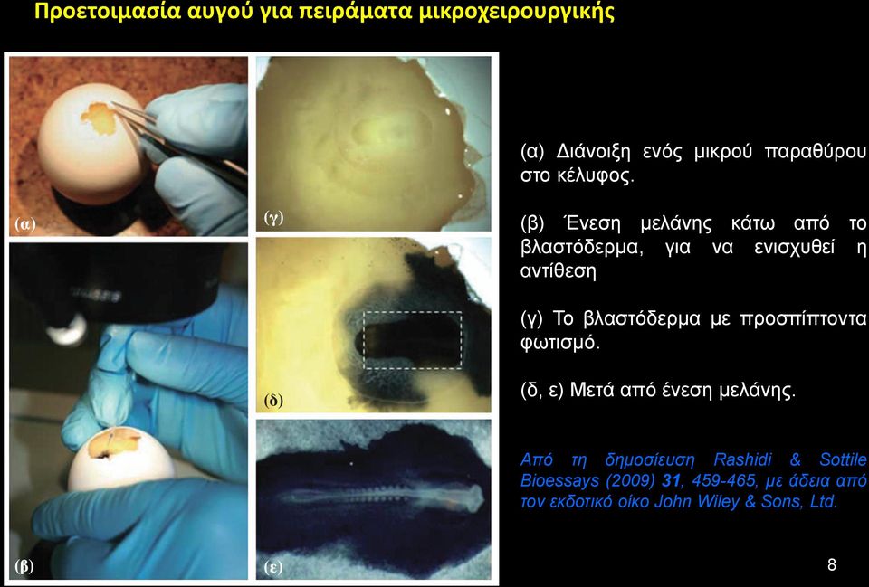 (β) Ένεση μελάνης κάτω από το βλαστόδερμα, για να ενισχυθεί η αντίθεση (γ) Το βλαστόδερμα