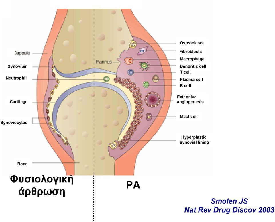angiogenesis Synoviocytes Mast cell Hyperplastic synovial