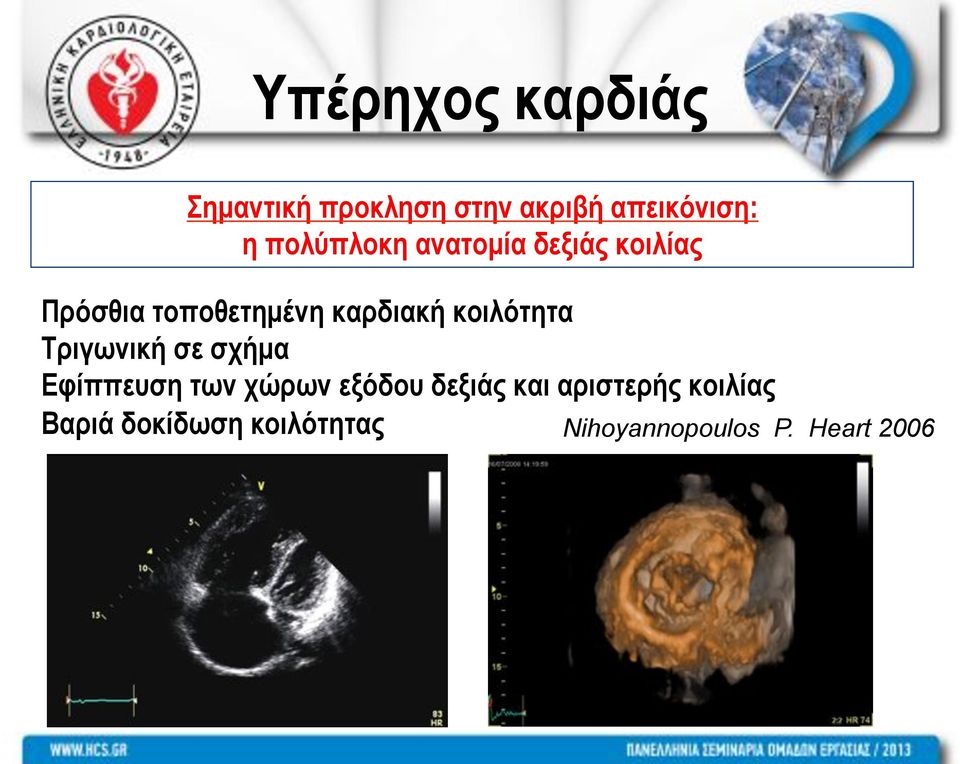 κοιλότητα Τριγωνική σε σχήµα Εφίππευση των χώρων εξόδου δεξιάς και