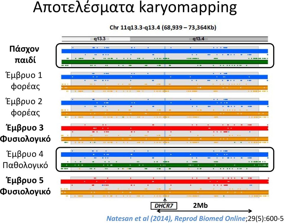 Έμβρυο 4 Παθολογικό Έμβρυο 5 Φυσιολογικό 2Mb