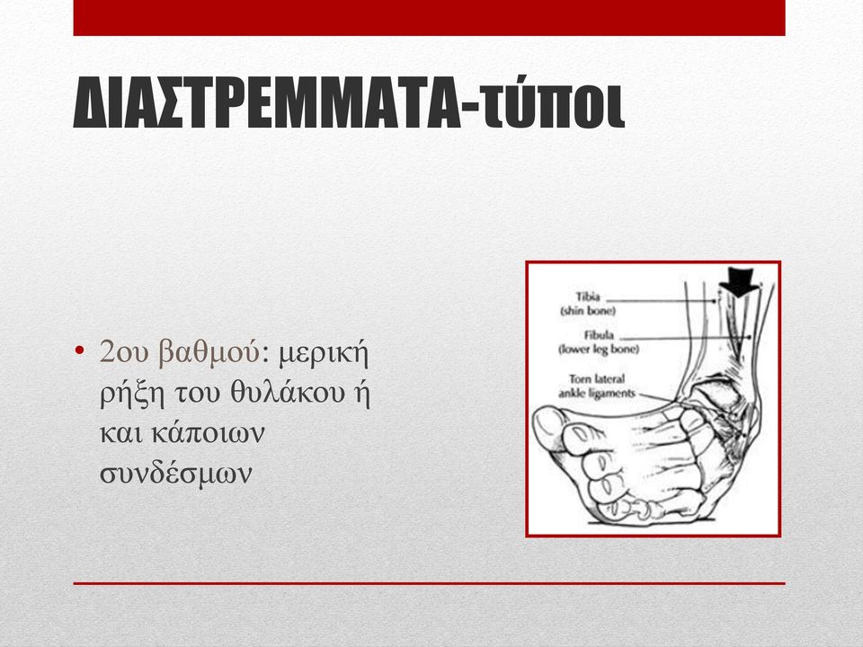 ξήμε ηνπ ζπιάθνπ ή