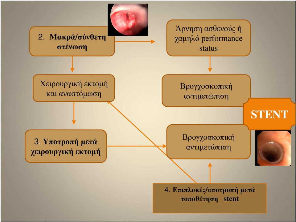 Βρογχοσκοπική αντιµετώπιση STENT 3.
