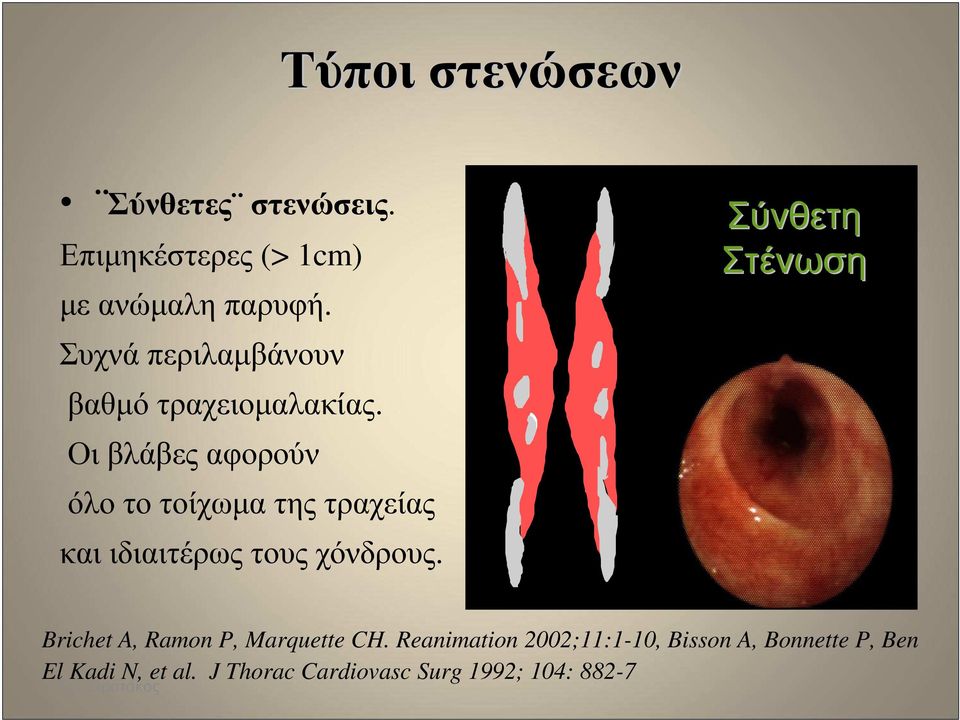 Οι βλάβες αφορούν όλο το τοίχωµα της τραχείας και ιδιαιτέρως τους χόνδρους.