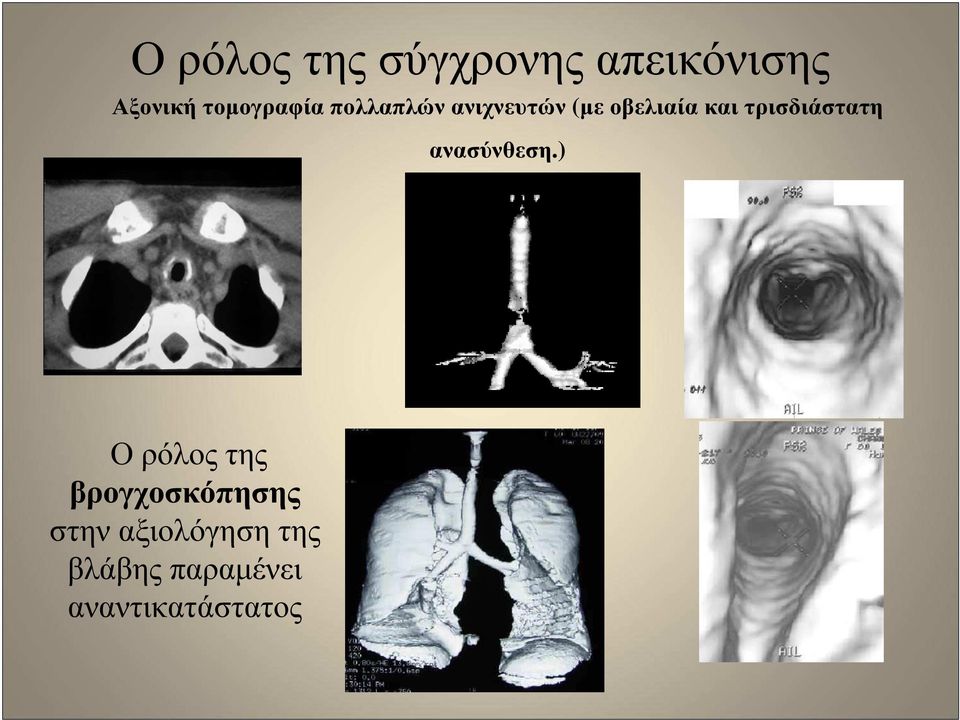 τρισδιάστατη ανασύνθεση.