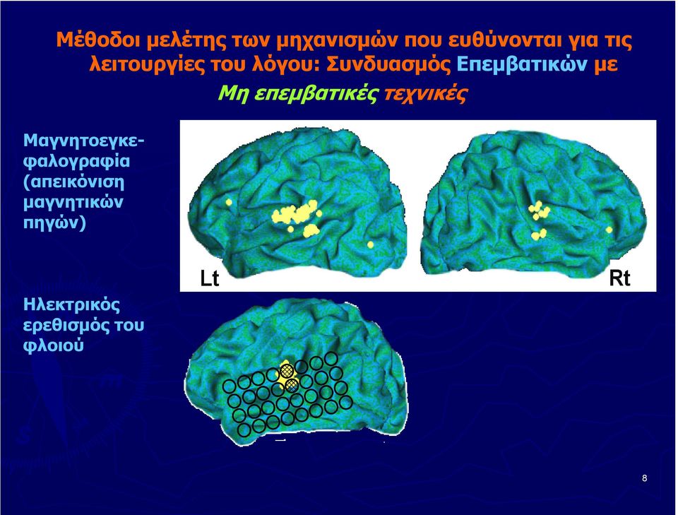 Μη επεμβατικές τεχνικές Μαγνητοεγκεφαλογραφία