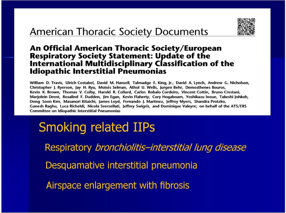 disease Desquamative interstitial