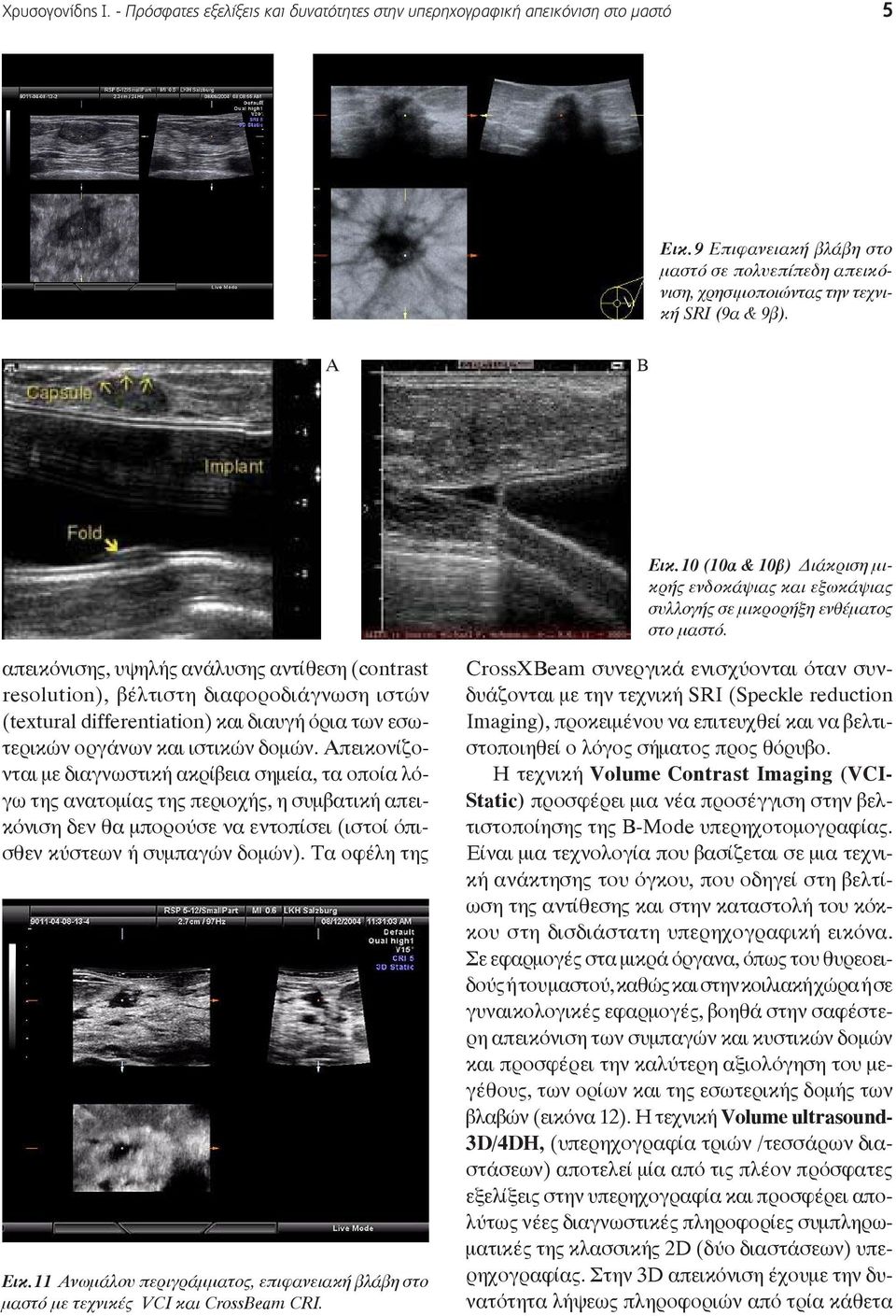 απεικόνισης, υψηλής ανάλυσης αντίθεση (contrast 10 α resolution), βέλτιστη διαφοροδιάγνωση 10β. ιστών (textural differentiation) και διαυγή όρια των εσωτερικών οργάνων και ιστικών δομών. πεικονίζο-.