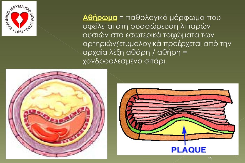 τοιχώματα των αρτηριών(ετυμολογικά προέρχεται