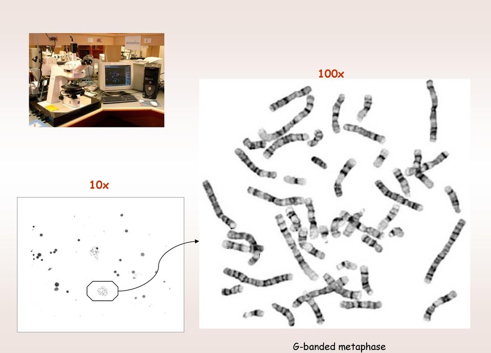 metaphase