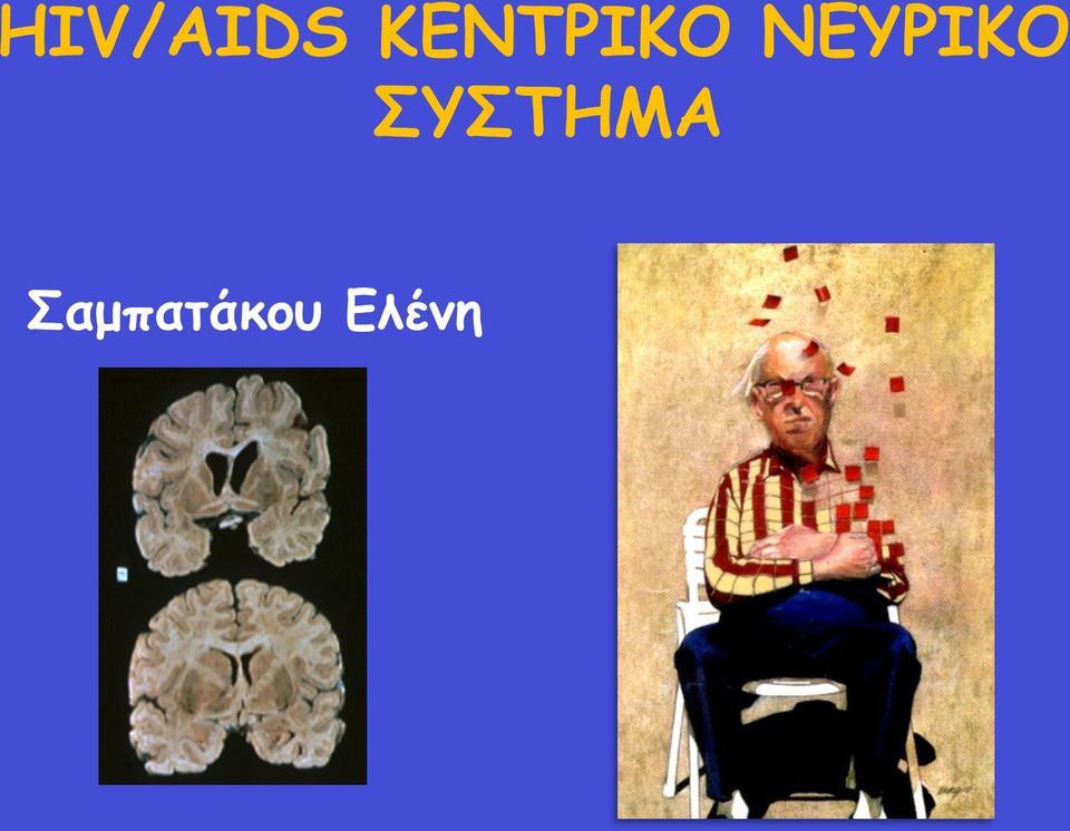 ΝΕΥΡΙΚΟ