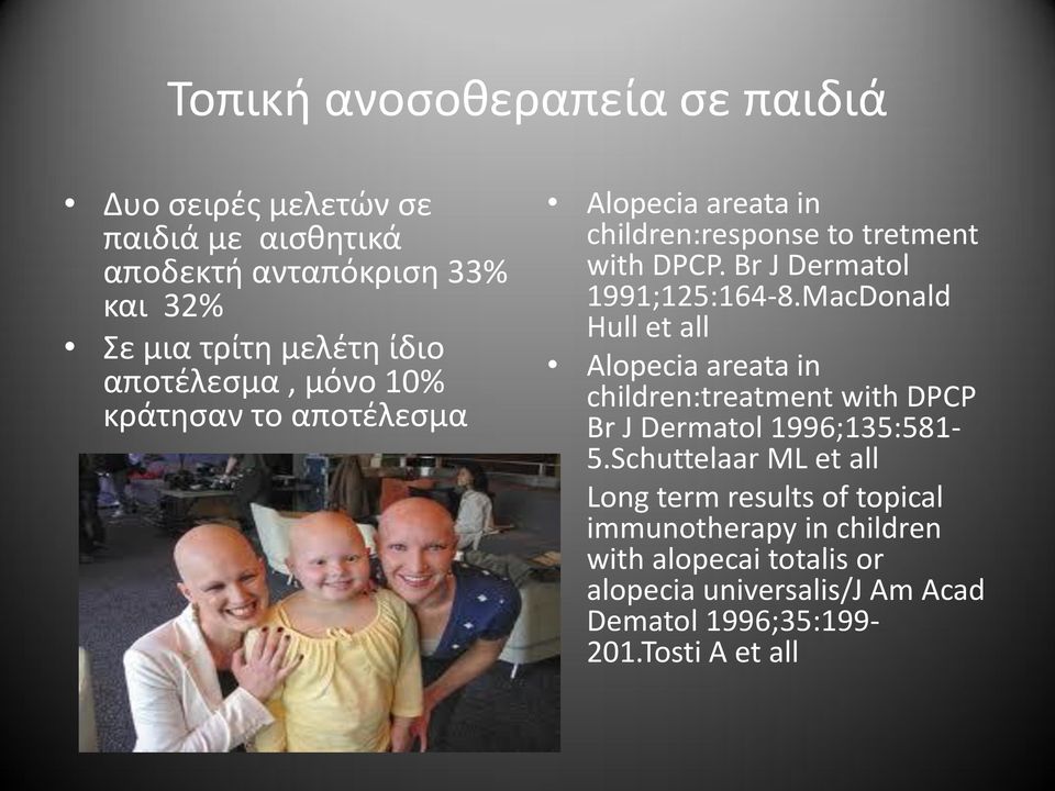 MacDonald Hull et all Alopecia areata in children:treatment with DPCP Br J Dermatol 1996;135:581-5.