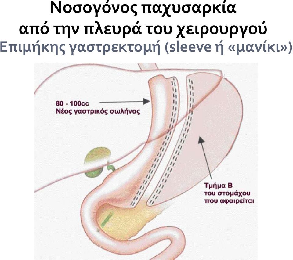 χειρουργού Επιμόκησ