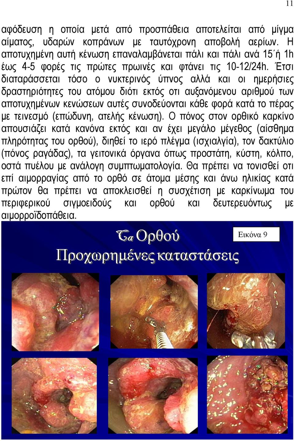 Έτσι διαταράσσεται τόσο ο νυκτερινός ύπνος αλλά και οι ημερήσιες δραστηριότητες του ατόμου διότι εκτός οτι αυξανόμενου αριθμού των αποτυχημένων κενώσεων αυτές συνοδεύονται κάθε φορά κατά το πέρας με