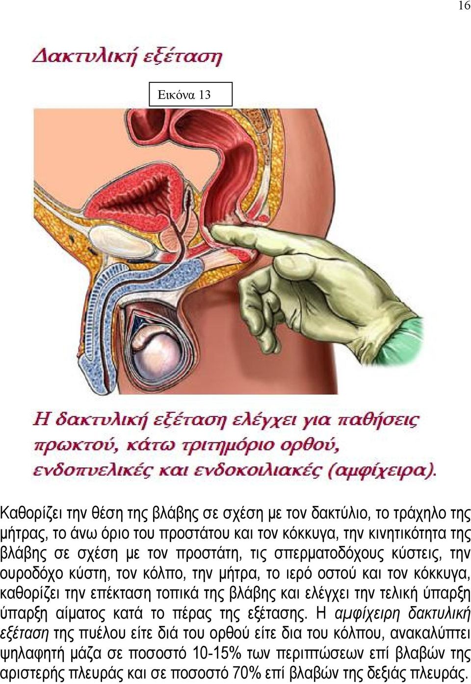 τοπικά της βλάβης και ελέγχει την τελική ύπαρξη ύπαρξη αίματος κατά το πέρας της εξέτασης.