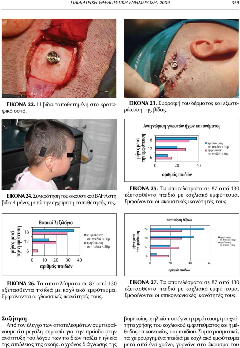 Συγκράτηση του ακουστικού ΒΑΗΑ στη βίδα 4 μήνες μετά την εγχείρηση τοποθέτησής της. Εικόνα 25. Τα αποτελέσματα σε 87 από 130 εξετασθέντα παιδιά με κοχλιακό εμφύτευμα.