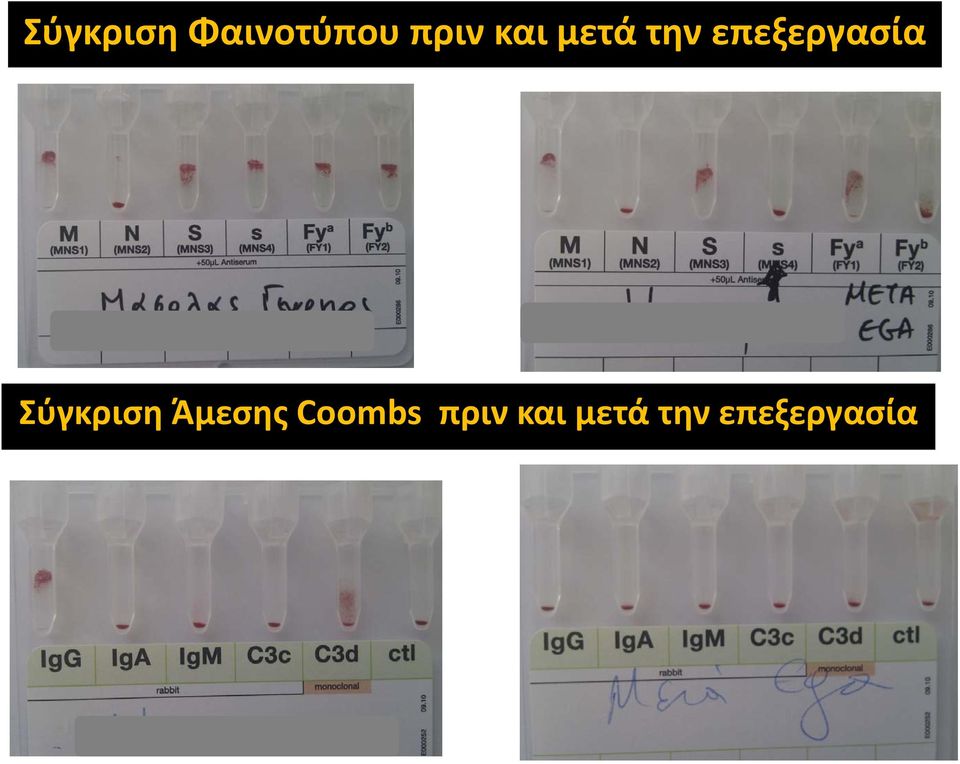 Σύγκριση Άμεσης Coombs