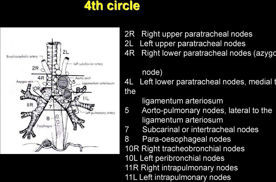 nodes, lateral to the ligamentum arteriosum 7 Subcarinal or intertracheal nodes 8 Para-oesophageal nodes 10R