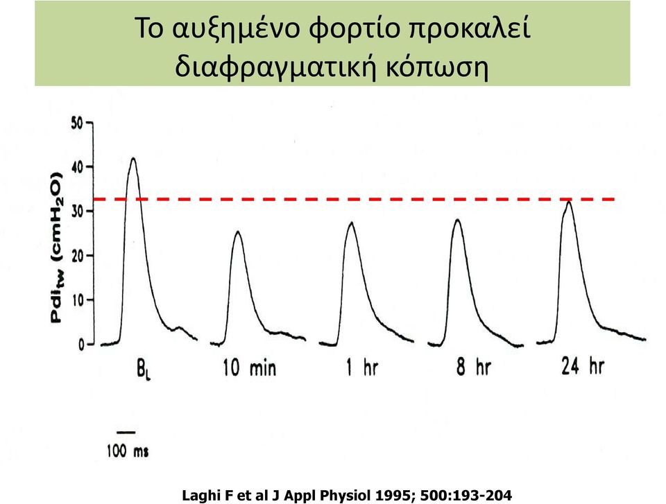 κόπωση Laghi F et al J