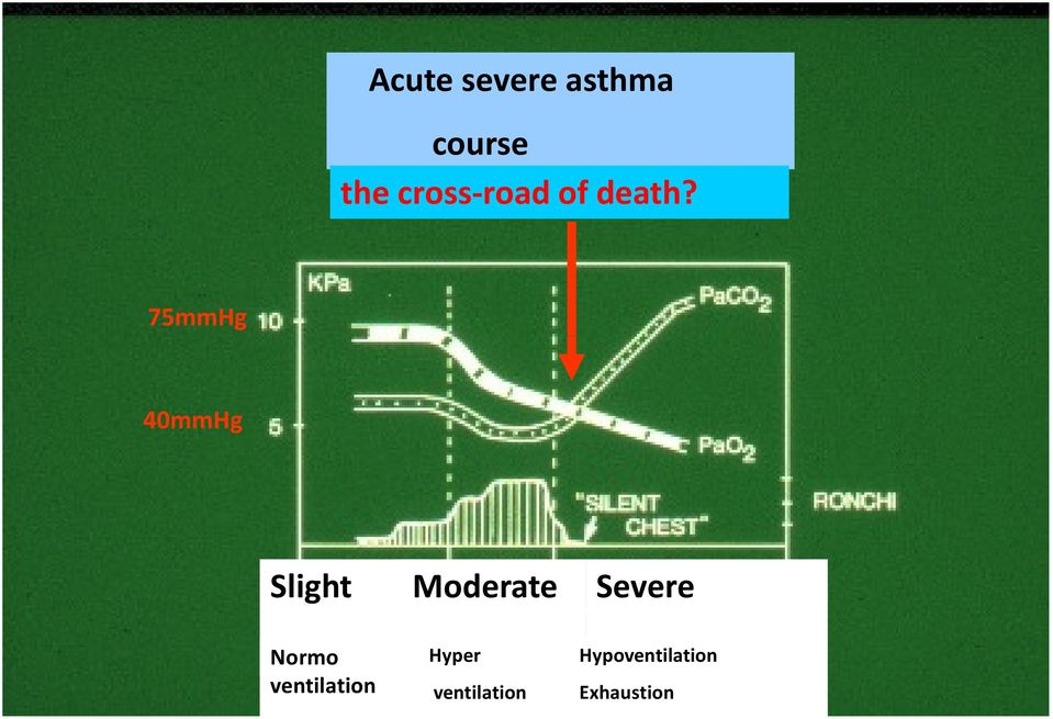 75mmHg 40mmHg Slight Moderate Severe