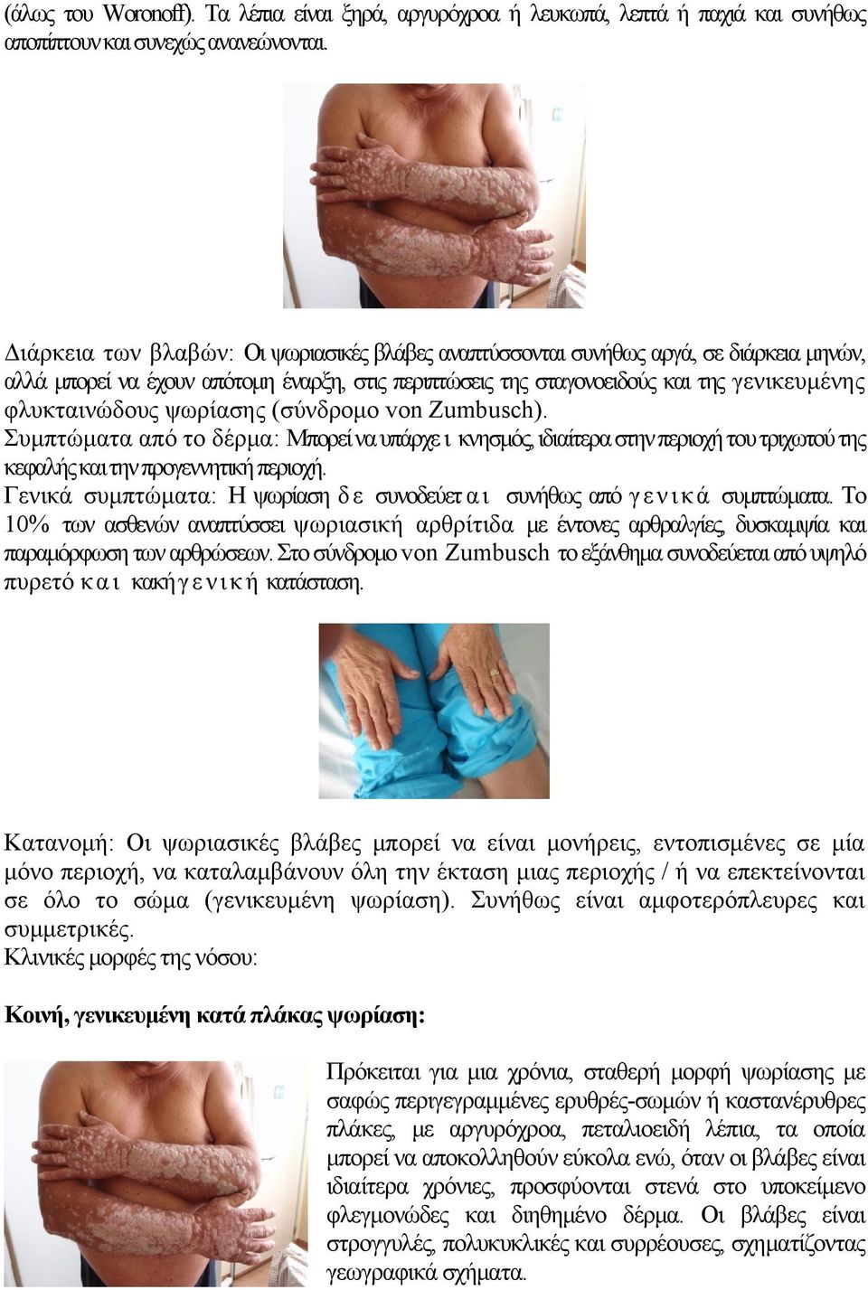 ψωρίασης (σύνδρομο von Zumbusch). Συμπτώματα από το δέρμα: Μπορεί να υπάρχε ι κνησμός, ιδιαίτερα στην περιοχή του τριχωτού της κεφαλής και την προγεννητική περιοχή.