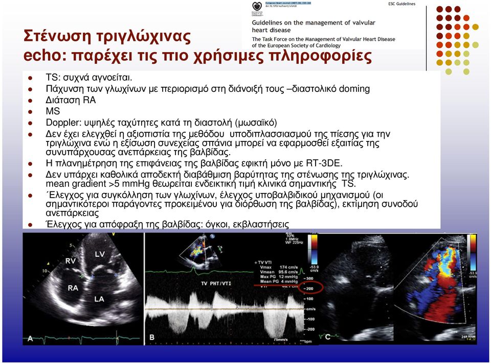 πίεσης για την τριγλώχινα ενώ η εξίσωση συνεχείας σπάνια µπορεί να εφαρµοσθεί εξαιτίας της συνυπάρχουσαςανεπάρκειαςτηςβαλβίδας. Ηπλανηµέτρησητηςεπιφάνειαςτηςβαλβίδαςεφικτήµόνοµε RT-3DE.