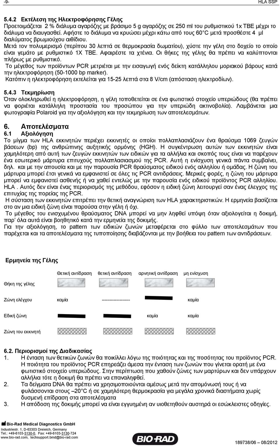 Μετά τον πολυμερισμό (περίπου 30 λεπτά σε θερμοκρασία δωματίου), χύστε την γέλη στο δοχείο το οποίο είναι γεμάτο με ρυθμιστικό 1Χ ΤΒΕ. Αφαιρέστε τα χτένια.