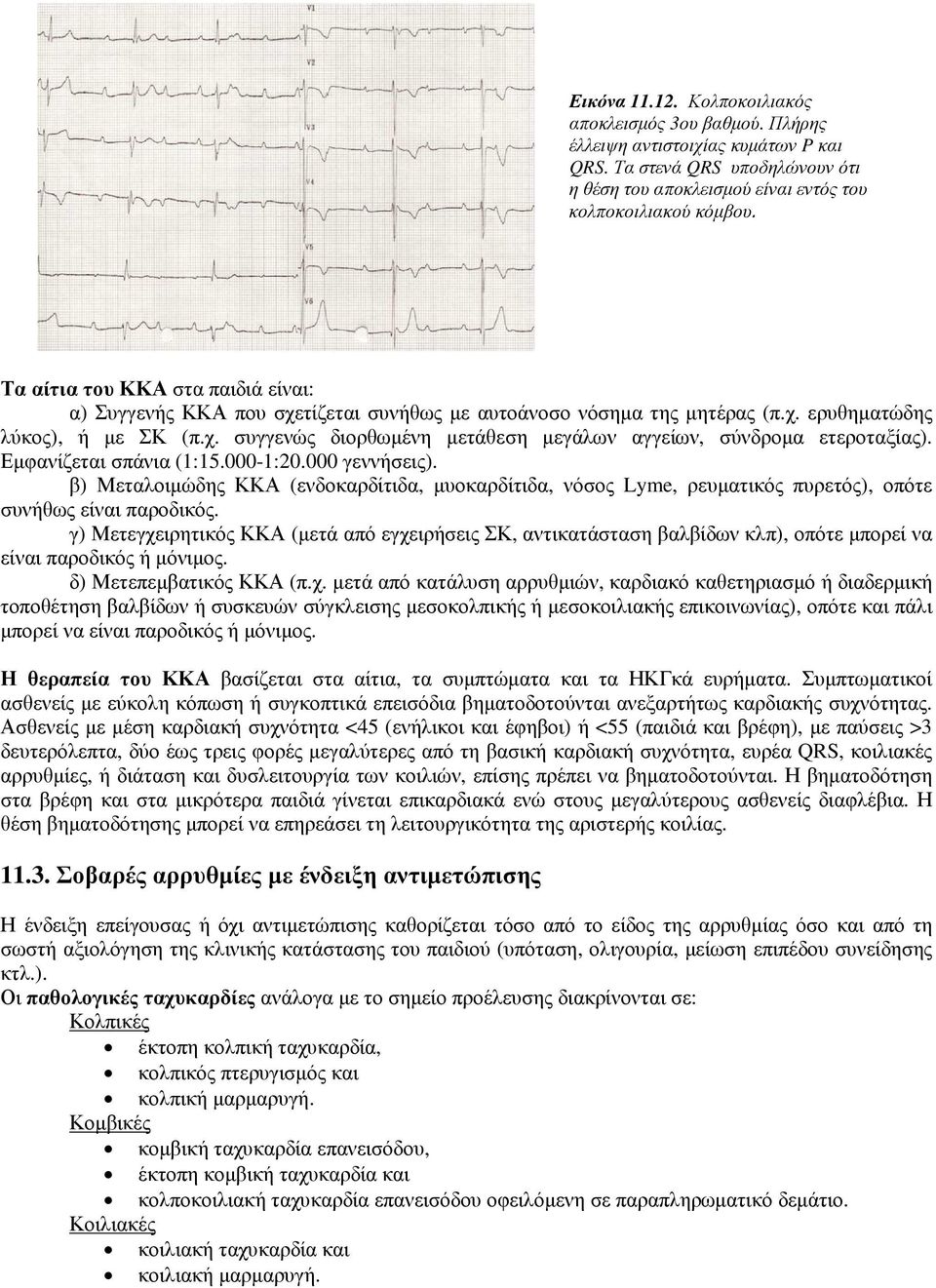 Εµφανίζεται σπάνια (1:15.000-1:20.000 γεννήσεις). β) Μεταλοιµώδης ΚΚΑ (ενδοκαρδίτιδα, µυοκαρδίτιδα, νόσος Lyme, ρευµατικός πυρετός), οπότε συνήθως είναι παροδικός.