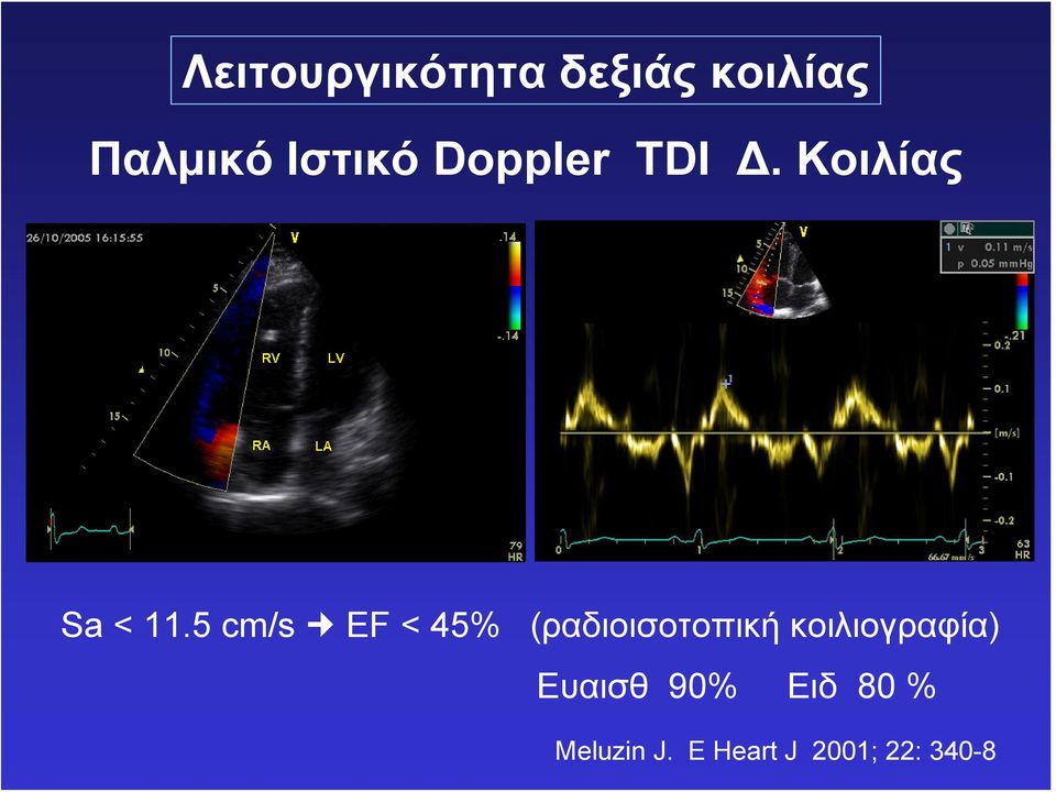 5 cm/s EF < 45% (ραδιοισοτοπική