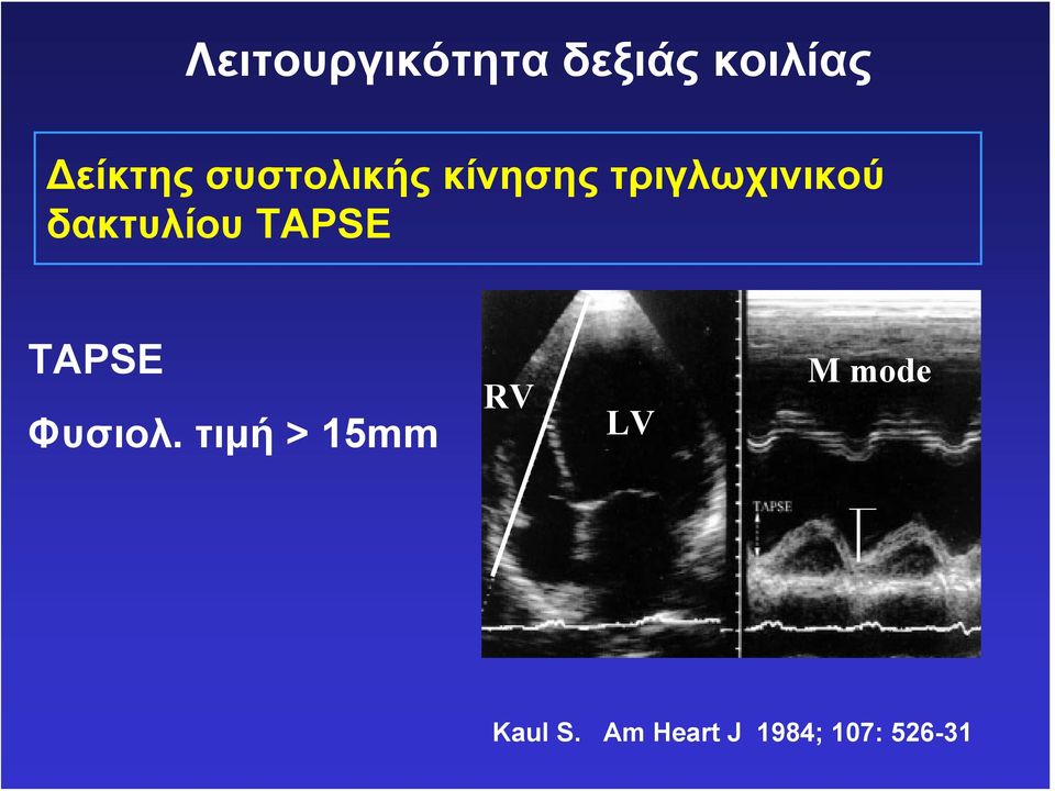 δακτυλίου TAPSE ΤΑPSE Φυσιολ.